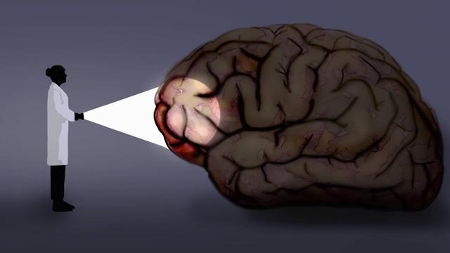 Symbolbild zum Thema Erforschung des Gehirns, der Gefühle, der menschlichen Verhaltensweisen: Wissenschaftlerin strahlt mit einer Taschenlampe auf ein menschliches Gehirn.