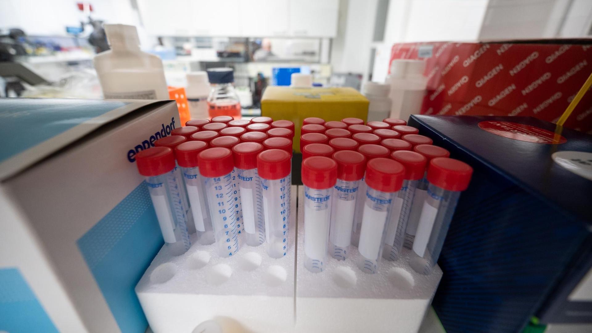 Im Institut für Virologie an der Charité Berlin Mitte, in dem Untersuchungen zum Coronavirus laufen, steht Laborausrüstung. Im Institut für Virologie an der Charité Berlin Mitte, in dem Untersuchungen zum Coronavirus laufen, steht Laborausrüstung.