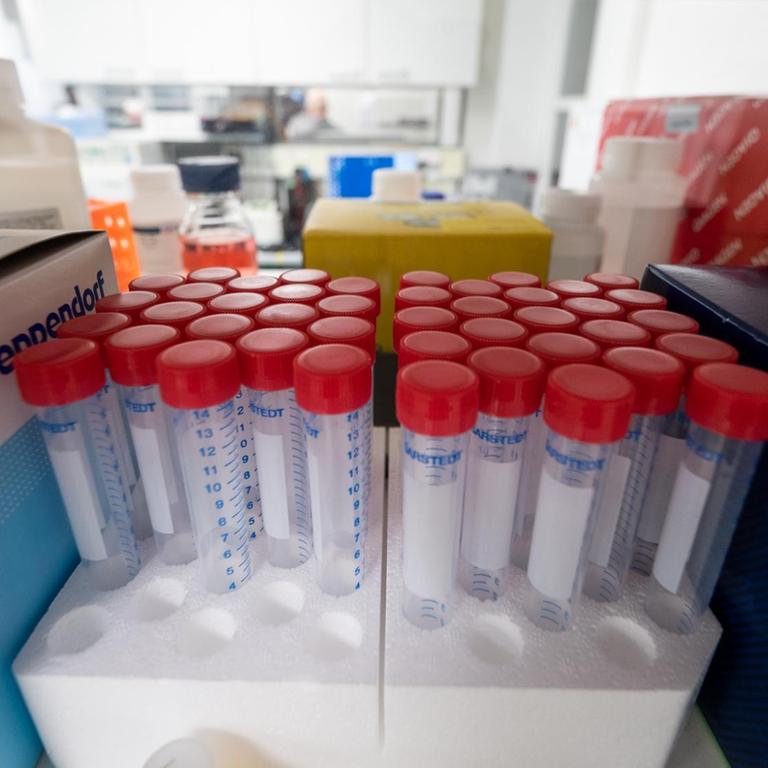 Im Institut für Virologie an der Charité Berlin Mitte, in dem Untersuchungen zum Coronavirus laufen, steht Laborausrüstung. 
