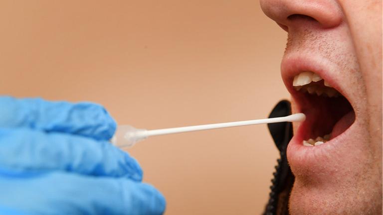 DNA-Speicheltest mit Wattestäbchen DNA-Speicheltest mit Wattestäbchen