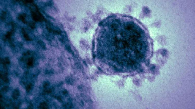 Das Corona-Virus vom Typ 2019-nCoV – auch bekannt als Wuhan-Virus. Das Corona-Virus vom Typ 2019-nCoV – auch bekannt als Wuhan-Virus.