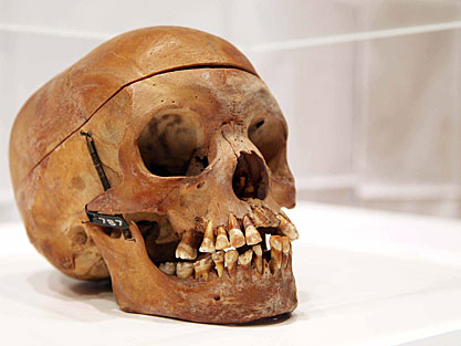 Ein Herero-Totenschädel aus der Sammlung der Charité Ein Herero-Totenschädel aus der Sammlung der Charité