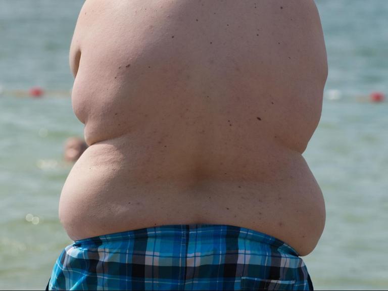 Ein übergewichtiger Junge in Badehose steht an einem Strand.