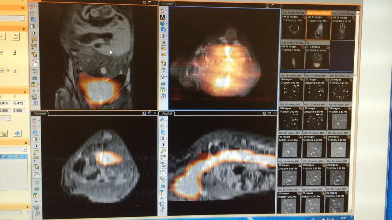 Magnetic Particle Imaging: ein MPI-Scan Magnetic Particle Imaging: ein MPI-Scan