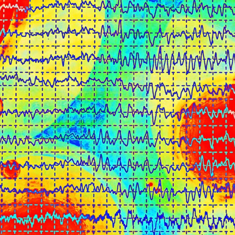 Darstellung von mehreren übereinanderliegenden Gehirnwellen im Elektroenzephalogramm (EEG), vor einem bunten Hintergrund.