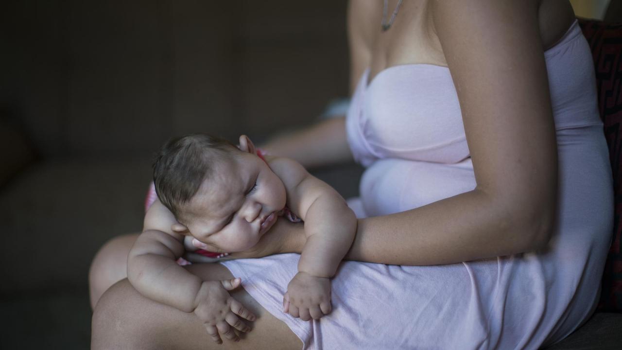 Eine Frau in Recife in Brasilien hält ihr Baby, das durch Mikrozephalie eine Schädelfehlbildung aufweist. Eine Frau in Recife in Brasilien hält ihr Baby, das durch Mikrozephalie eine Schädelfehlbildung aufweist.