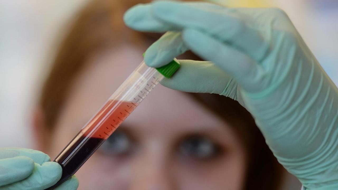 Eine Medizinisch-Technische Aisstentin überprüft die Blutprobe einer schwangeren Frau auf Trisomien 21, 18 und 13 beim ungeborenen Kind Eine Medizinisch-Technische Aisstentin überprüft die Blutprobe einer schwangeren Frau auf Trisomien 21, 18 und 13 beim ungeborenen Kind