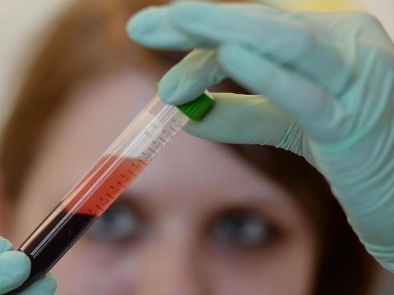 Eine Medizinisch-Technische Aisstentin überprüft die Blutprobe einer schwangeren Frau auf Trisomien 21, 18 und 13 beim ungeborenen Kind