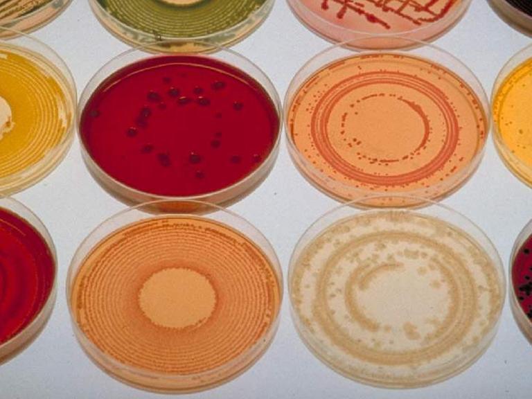 Verschiedene Petrischalen mit Bakterienkulturen eines amerikanischen Labors, das in den 1970er Jahren Pockenimpfstoff herstellt.