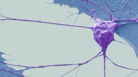 Colorierter Scan eines Motoneurons aus einer Stammzelle.