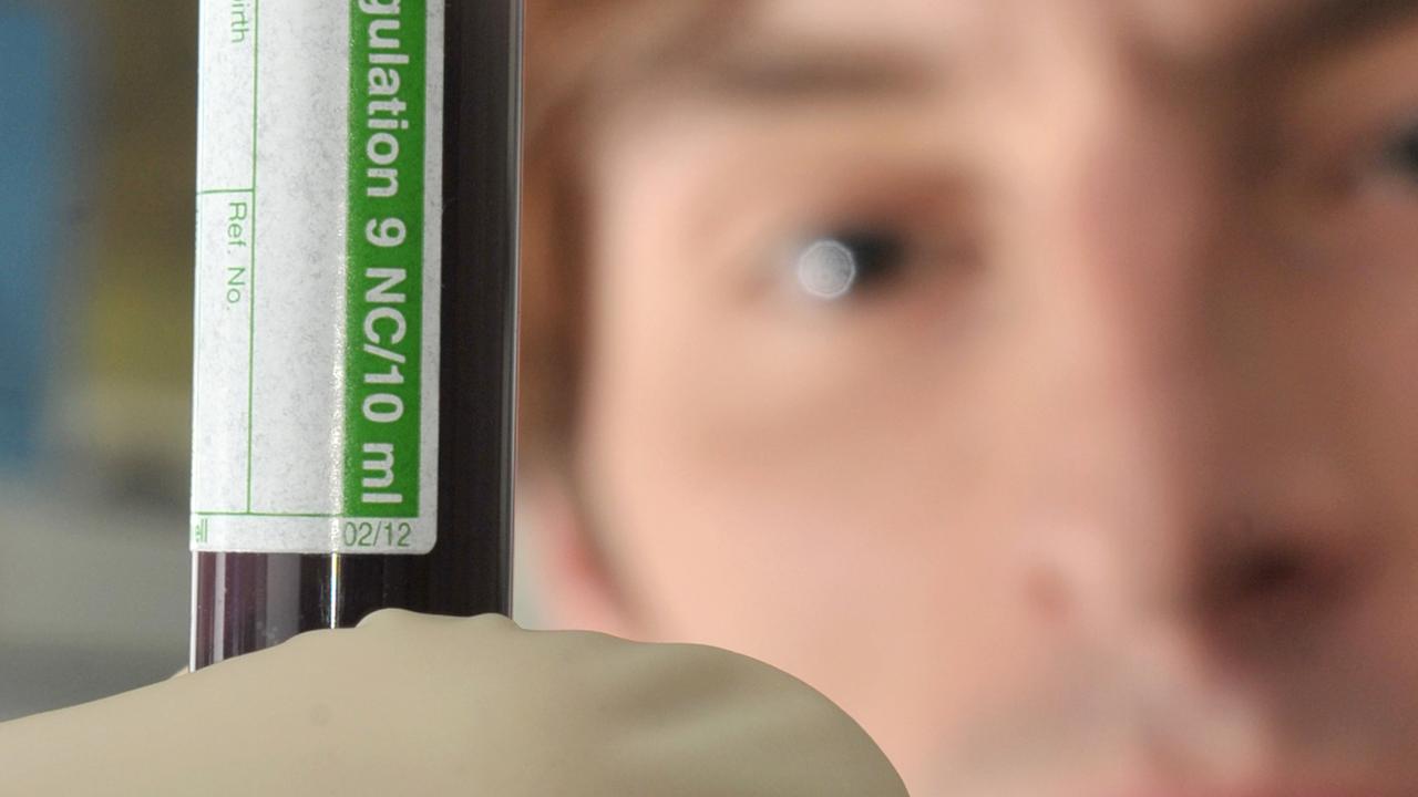 In einem Labor des medizinischen Forschungszentrums am Universitätsklinikum Jena betrachtet ein Mitarbeiter eine Blutprobe, die für einen Gerinnungstest vorbereitet wird. In einem Labor des medizinischen Forschungszentrums am Universitätsklinikum Jena betrachtet ein Mitarbeiter eine Blutprobe, die für einen Gerinnungstest vorbereitet wird.