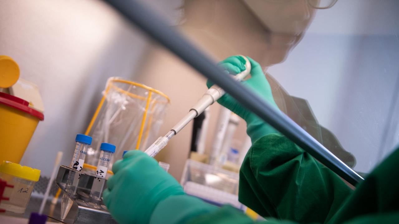 Eine Mitarbeiterin des Landesgesundheitsamts Baden-Württemberg pipettiert einen Abstrich eines 2019-nCoV Verdachtsfalles aus Baden-Württemberg Eine Mitarbeiterin des Landesgesundheitsamts Baden-Württemberg pipettiert einen Abstrich eines 2019-nCoV Verdachtsfalles aus Baden-Württemberg