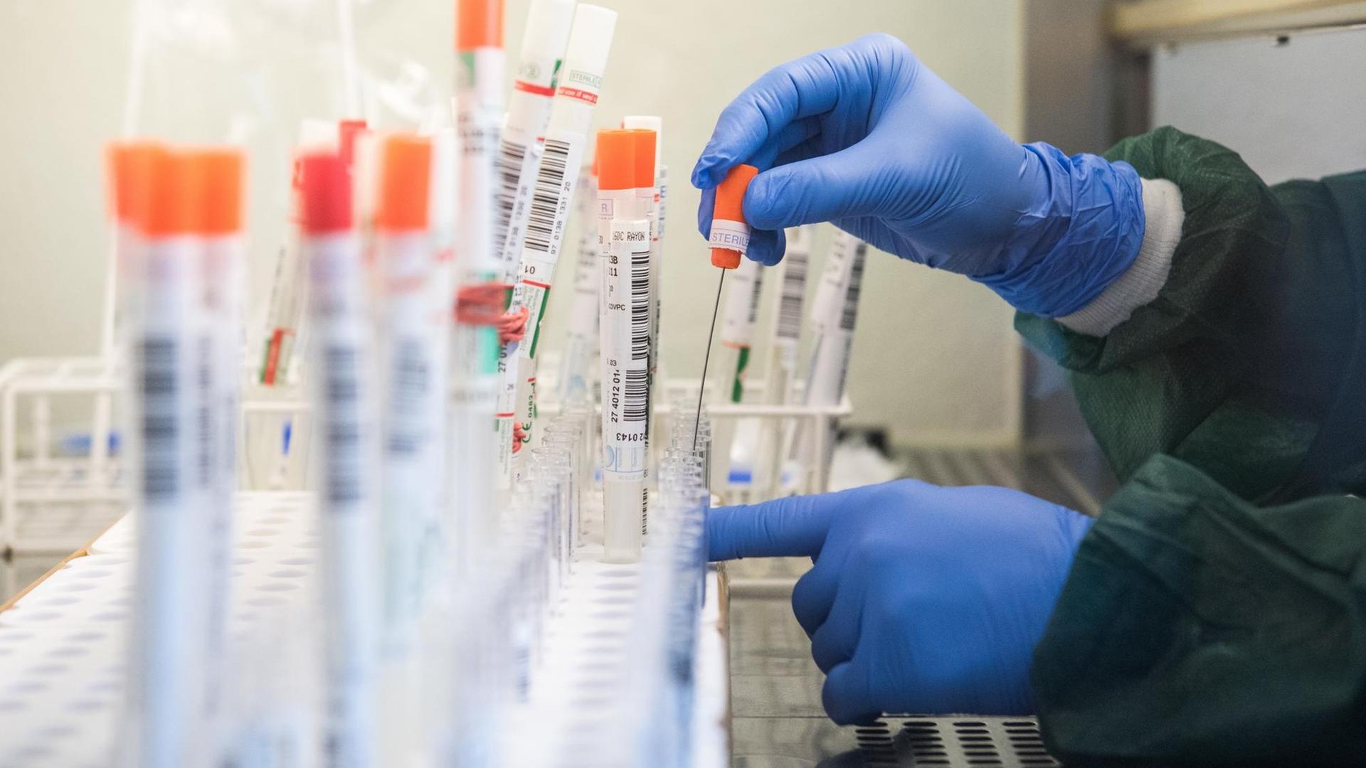 Coronavirus-Testauswertung in einem Labor in Geesthacht in Schleswig-Holstein. Eine Person mit blauen Schutzhandschuhen befüllt Teströhrchen. Coronavirus-Testauswertung in einem Labor in Geesthacht in Schleswig-Holstein. Eine Person mit blauen Schutzhandschuhen befüllt Teströhrchen.