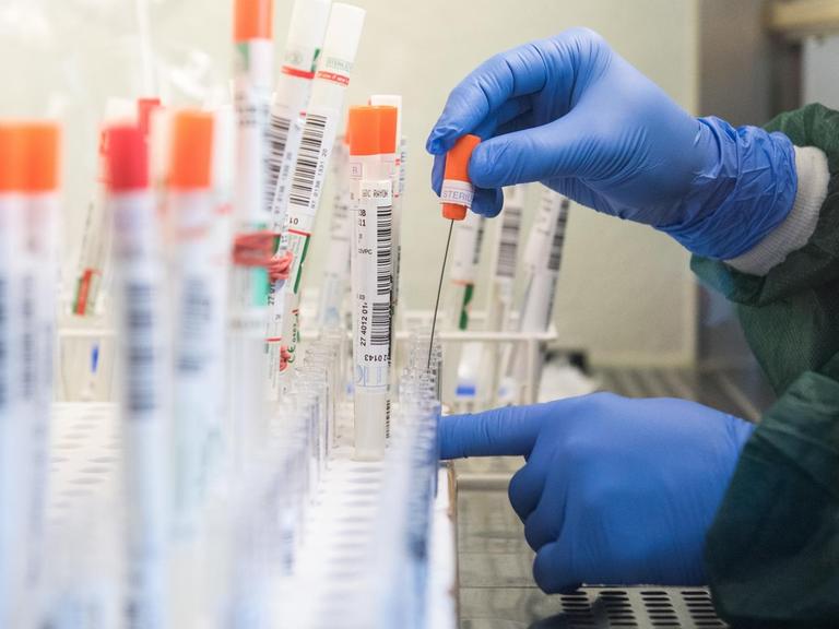 Coronavirus-Testauswertung in einem Labor in Geesthacht in Schleswig-Holstein. Eine Person mit blauen Schutzhandschuhen befüllt Teströhrchen.