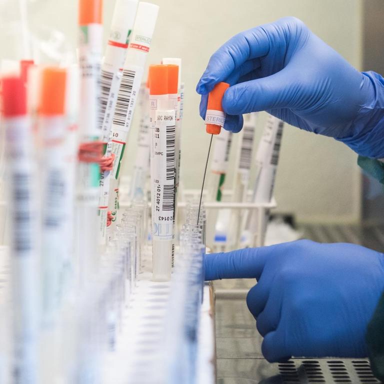 Coronavirus-Testauswertung in einem Labor in Geesthacht in Schleswig-Holstein. Eine Person mit blauen Schutzhandschuhen befüllt Teströhrchen.