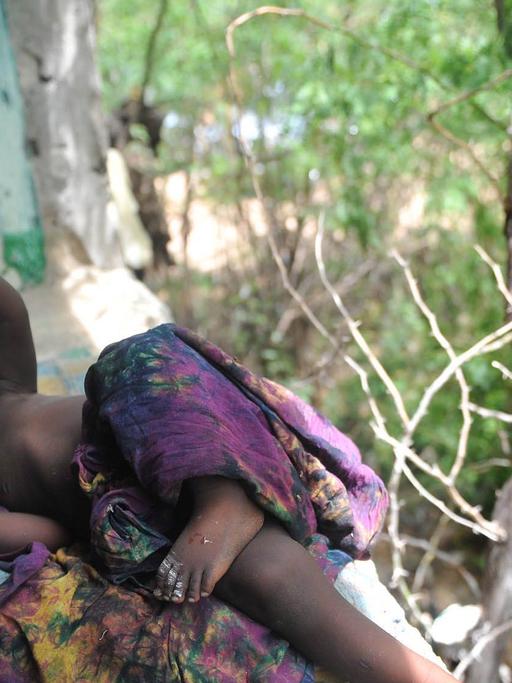 Ein südafrikanischer Arzt versorgt ein unterernährtes Kind in Somalia.