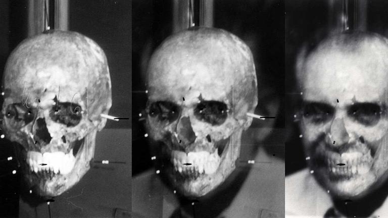 Die Installation "Mengele's skull" (2012) von Thomas Keenan und Eyal Weizman hängt in der Ausstellung "Evidentiary Realism" (2.12.2017 - 17.2.2018) in der Berliner Galerie NOME. Die Installation "Mengele's skull" (2012) von Thomas Keenan und Eyal Weizman hängt in der Ausstellung "Evidentiary Realism" (2.12.2017 - 17.2.2018) in der Berliner Galerie NOME.