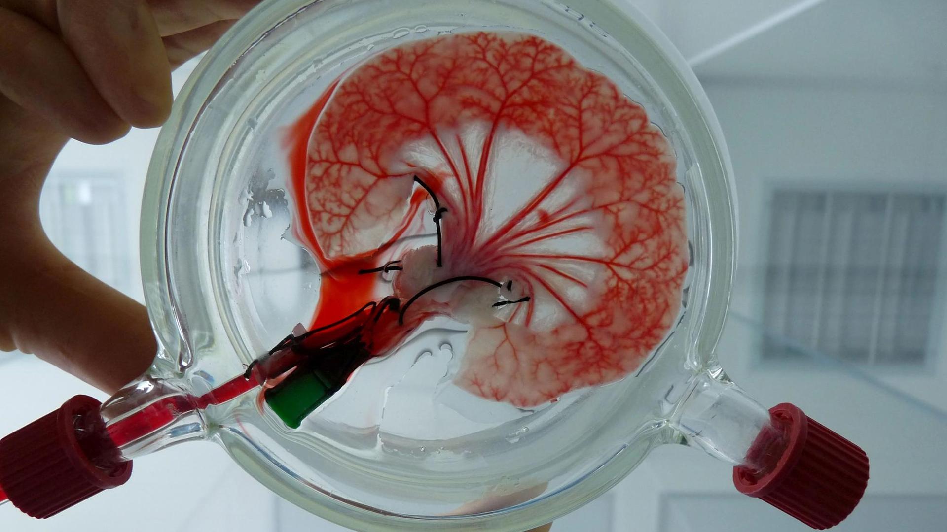 Regenerative Medizin: Die BioVaSc-TERM ist eine Trägerstruktur für das Tissue Engineering. Über die intakte Blutgefäßstruktur wird das Gewebe mit Nährstoffen versorgt. Regenerative Medizin: Die BioVaSc-TERM ist eine Trägerstruktur für das Tissue Engineering. Über die intakte Blutgefäßstruktur wird das Gewebe mit Nährstoffen versorgt.