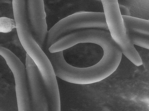 Ein Fadenwurm bei der Eiablage, aufgenommen mit einem Raster-Elektronenmikroskop.