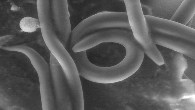Ein Fadenwurm bei der Eiablage, aufgenommen mit einem Raster-Elektronenmikroskop.
