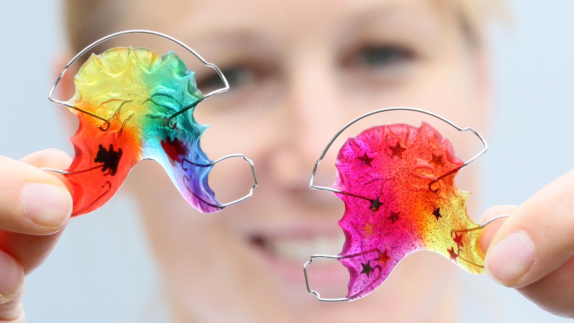 Zahnspangen in Regenbogenfarben sind am 26.09.2014 an der Charité, Campus Benjamin Franklin für Zahn- Mund- und Kieferheilkunde, in Berlin zu sehen. Zahnspangen in Regenbogenfarben sind am 26.09.2014 an der Charité, Campus Benjamin Franklin für Zahn- Mund- und Kieferheilkunde, in Berlin zu sehen.