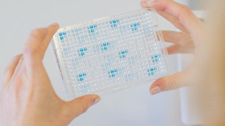 Eine Wissenschaftlerin hält eine durchsichtige ELISA-Testplatte mit zahlreichen Vertiefungen gegen das Licht. In einigen der Vertiefungen hat sich die darin enthaltenen Flüssigkeit in unterschiedlicher Stärke blau verfärbt. Eine Wissenschaftlerin hält eine durchsichtige ELISA-Testplatte mit zahlreichen Vertiefungen gegen das Licht. In einigen der Vertiefungen hat sich die darin enthaltenen Flüssigkeit in unterschiedlicher Stärke blau verfärbt.