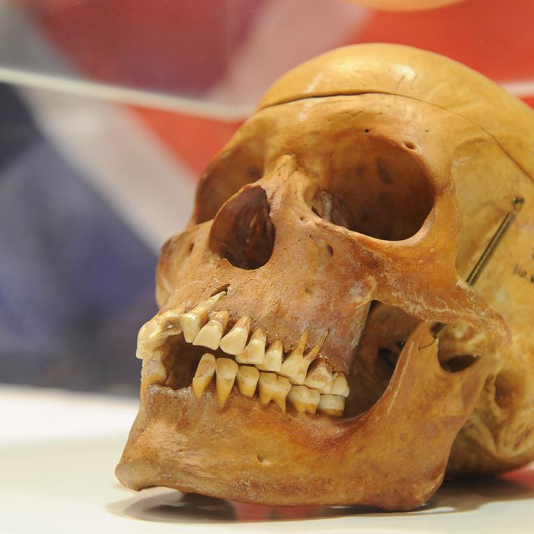 Bei der Übergabe von 20 Schädeln an die Opferorganisation "Ovaherero/ Ovambanderu - Rat für Dialog über den Genozid von 1904" steht ein Schädel am Freitag (30.09.2011) in der Berliner Charité hinter Plexiglas. Vor mehr als hundert Jahren ermordeten deutsche Soldaten tausende Einwohner der damaligen Kolonie Deutsch-Südwestafrika. 