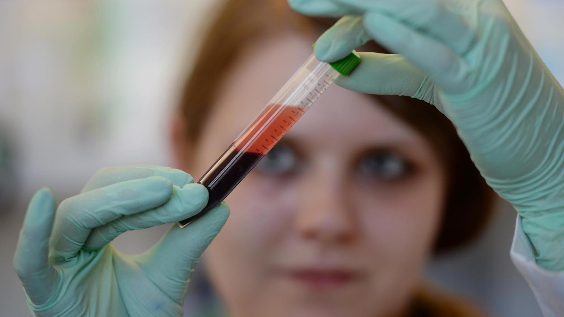 Eine Medizinisch-Technische Aisstentin überprüft die Blutprobe einer schwangeren Frau auf Trisomien 21, 18 und 13 beim ungeborenen Kind