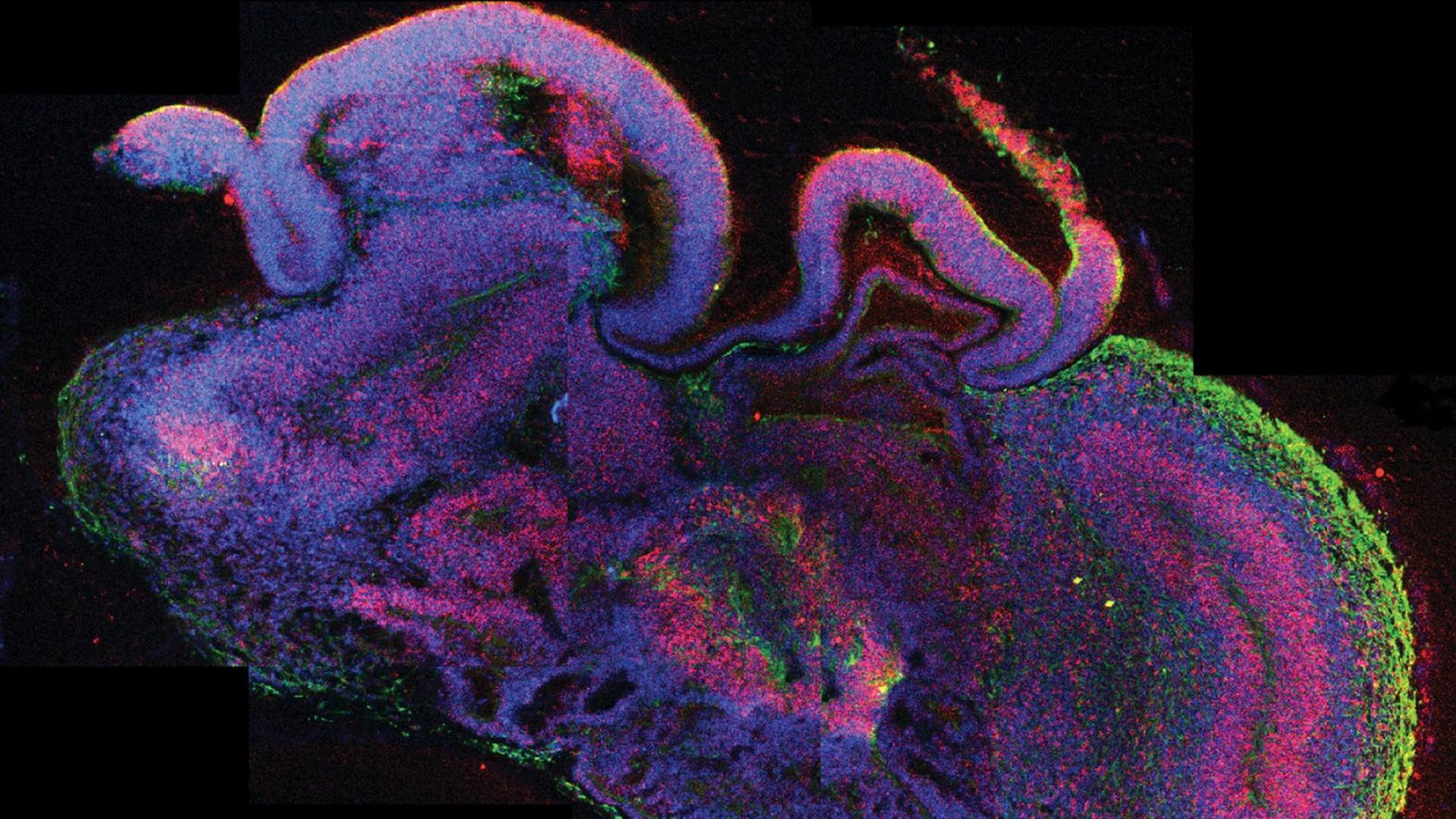 Undatierte mikroskopische Querschnittsaufnahme eines ganzen zerebralen Organoids. Undatierte mikroskopische Querschnittsaufnahme eines ganzen zerebralen Organoids.