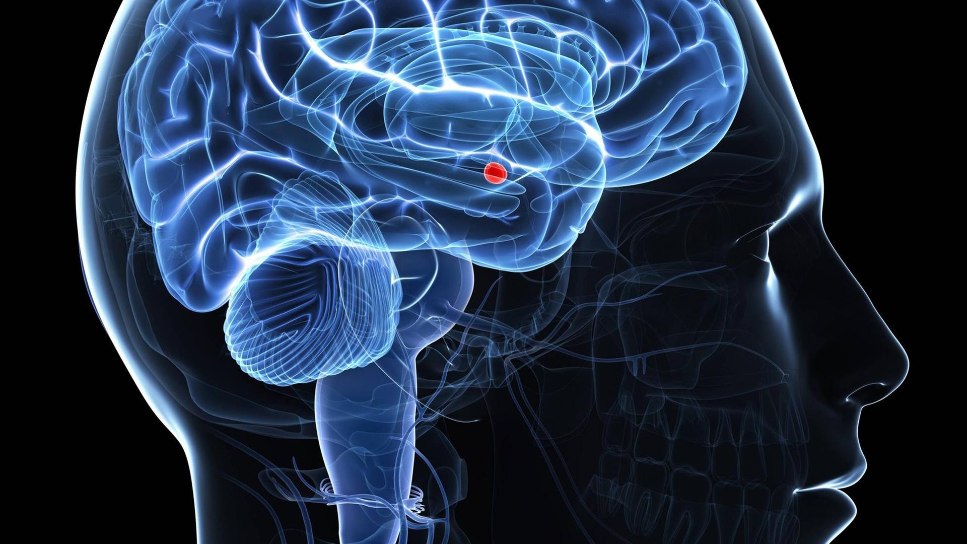 Grafik vom Gehirn; die Amygdala ist rot gekennzeichnet.