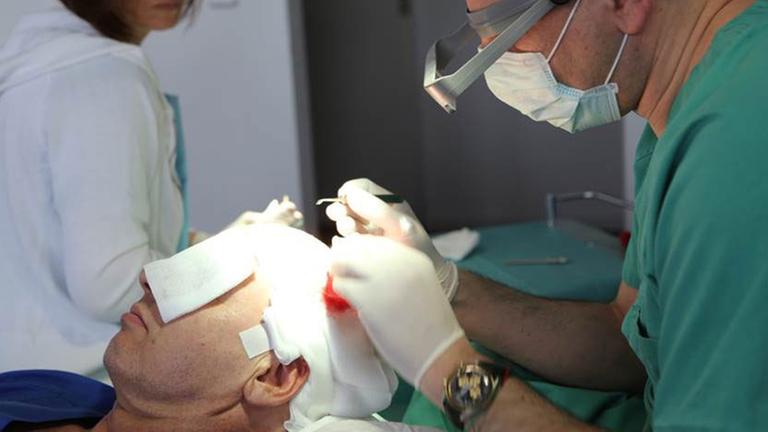 Haartransplantation Haartransplantation