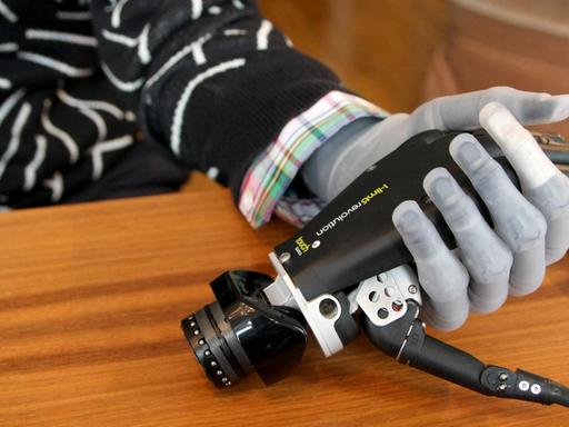 Das Foto zeigt einen Arm mit einer bionischen Handprothese, die ein weiteres Modell in der Hand hält