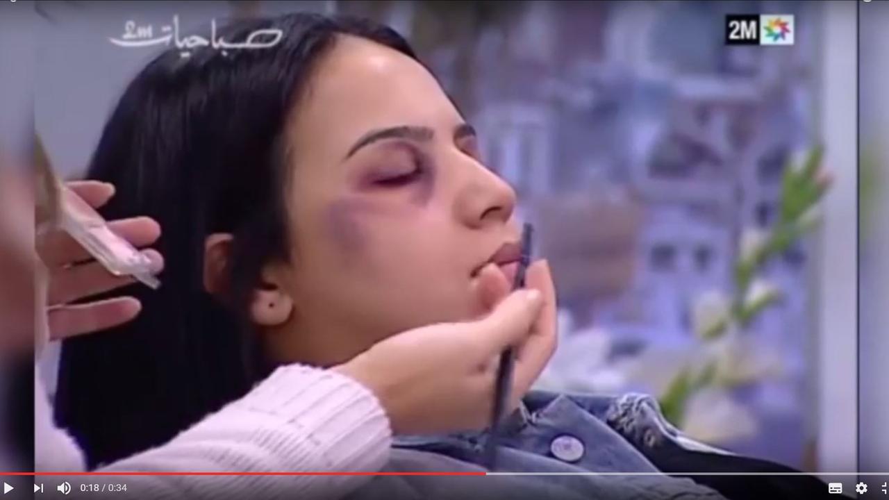 Make-up-Artist Lilia Mouline schminkt eine junge Frau mit blauem Auge im TV. Make-up-Artist Lilia Mouline schminkt eine junge Frau mit blauem Auge im TV.