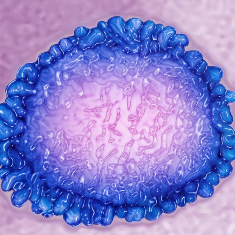 Bild eines Coronavirus, das mit Hilfe von High-Dynamic-Range-Imaging (HDRI) aus einem mit Transmissionselektronenmikroskop erzeugt wird. Viraler Durchmesser etwa 80-160 nm.