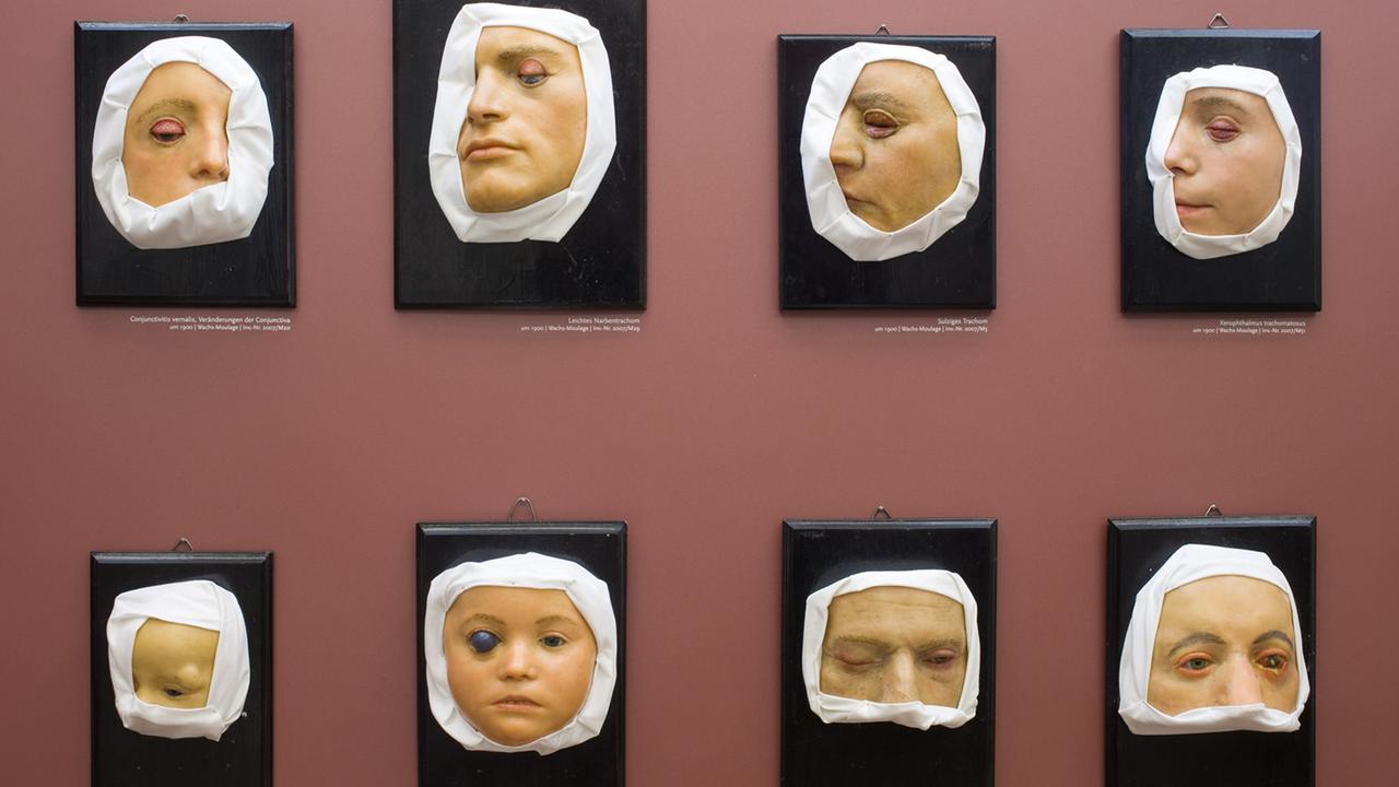 Blick in die Moulagensammlung der Berliner Charité Blick in die Moulagensammlung der Berliner Charité