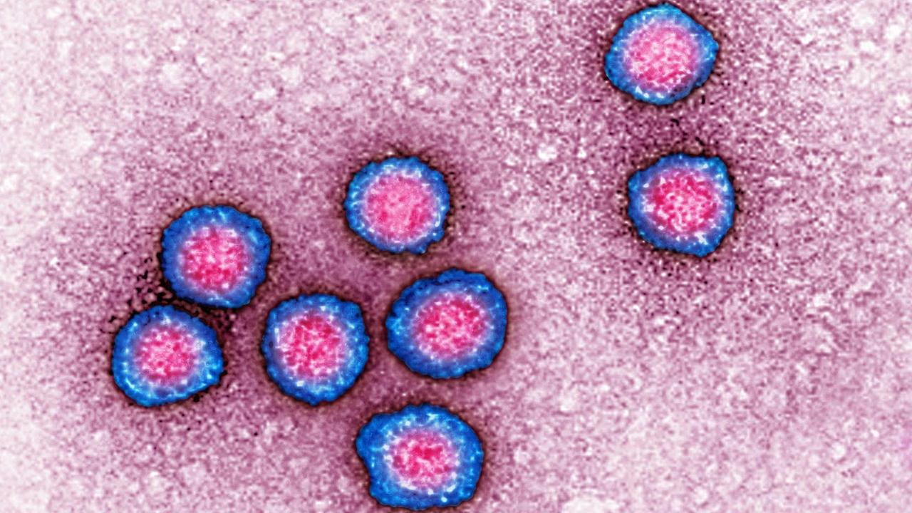 Visualisierung eines Flavivirus mit einem Transmissionselektronenmikroskop
Visualisierung eines Flavivirus mit einem Transmissionselektronenmikroskop