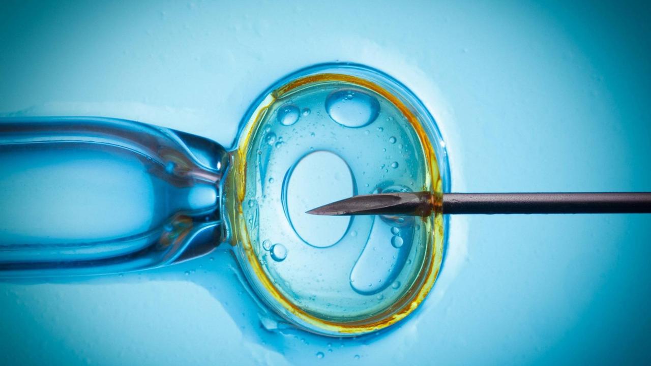 Spermieninjektion als Methode der künstlichen Befruchtung. In Tschechien ist fast alles erlaubt, was medizinisch möglich ist. Spermieninjektion als Methode der künstlichen Befruchtung. In Tschechien ist fast alles erlaubt, was medizinisch möglich ist.