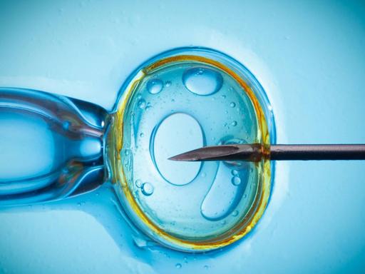 Spermieninjektion als Methode der künstlichen Befruchtung. In Tschechien ist fast alles erlaubt, was medizinisch möglich ist.