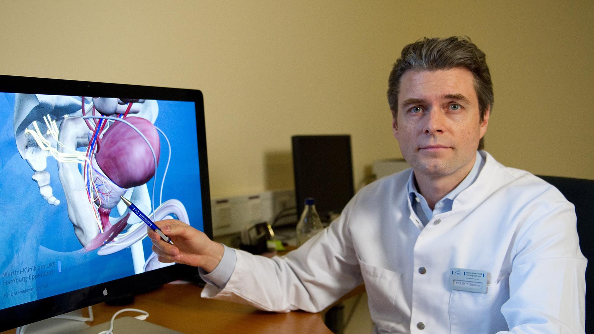 Professor Thorsten Schlomm zeigt in der Martini-Klinik am Universitätsklinikum Hamburg-Eppendorf auf ein 3D-Modell einer Prostata.