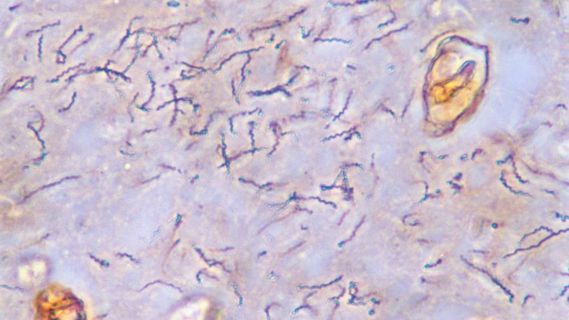 Syphilis-Erreger unter dem Mikroskop Syphilis-Erreger unter dem Mikroskop
