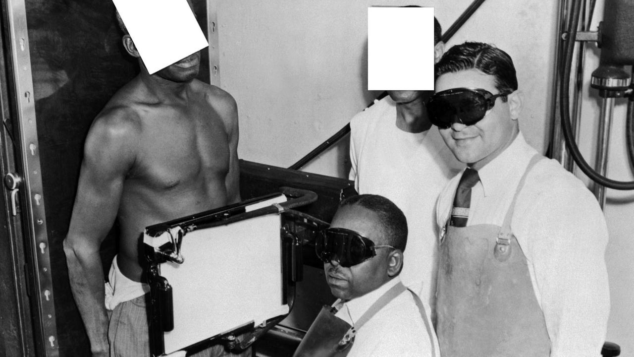 Tuskegee Syphilis Study participant being X-rayed, circa 1932. The Tuskegee Syphilis Study was carried out in Macon County, Alabama, USA, from 1932 to 1972 by the United States Public Health Service. Its objective was to study the natural course of untreated syphilis. The study recruited 600 poor African-Americans, 399 of whom had syphilis. Participants were not told their diagnosis and were only treated with placebos, even after penicillin was found to be an effective treatment for the disease. Of the original participants, 28 died as a result of syphilis and a further 100 of complications of the disease, 40 wives were infected and 19 children born with congenital syphilis. Condemnation of the study lead to congressional acts and laws that regulated human clinical trials, ensured informed consent and protected participants. Tuskegee Syphilis Study participant being X-rayed, circa 1932. The Tuskegee Syphilis Study was carried out in Macon County, Alabama, USA, from 1932 to 1972 by the United States Public Health Service. Its objective was to study the natural course of untreated syphilis. The study recruited 600 poor African-Americans, 399 of whom had syphilis. Participants were not told their diagnosis and were only treated with placebos, even after penicillin was found to be an effective treatment for the disease. Of the original participants, 28 died as a result of syphilis and a further 100 of complications of the disease, 40 wives were infected and 19 children born with congenital syphilis. Condemnation of the study lead to congressional acts and laws that regulated human clinical trials, ensured informed consent and protected participants.