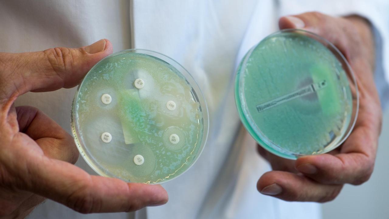 Petrischalen mit Antibiotikatestplatten mit Pseudomonas aeruginosa (grünes schleimiges Wachstum), aufgenommen am 10.04.2017 im Universitätsklinikum Regensburg (Bayern). Wulf Schneider ist Bayerns erster Professor für Krankenhaushygiene. Am Klinikum der Universität Regensburg bildet er Ärzte und medizinisches Fachpersonal weiter, berät Kliniken in Ostbayern und erforscht multiresistente Keime. Petrischalen mit Antibiotikatestplatten mit Pseudomonas aeruginosa (grünes schleimiges Wachstum), aufgenommen am 10.04.2017 im Universitätsklinikum Regensburg (Bayern). Wulf Schneider ist Bayerns erster Professor für Krankenhaushygiene. Am Klinikum der Universität Regensburg bildet er Ärzte und medizinisches Fachpersonal weiter, berät Kliniken in Ostbayern und erforscht multiresistente Keime.