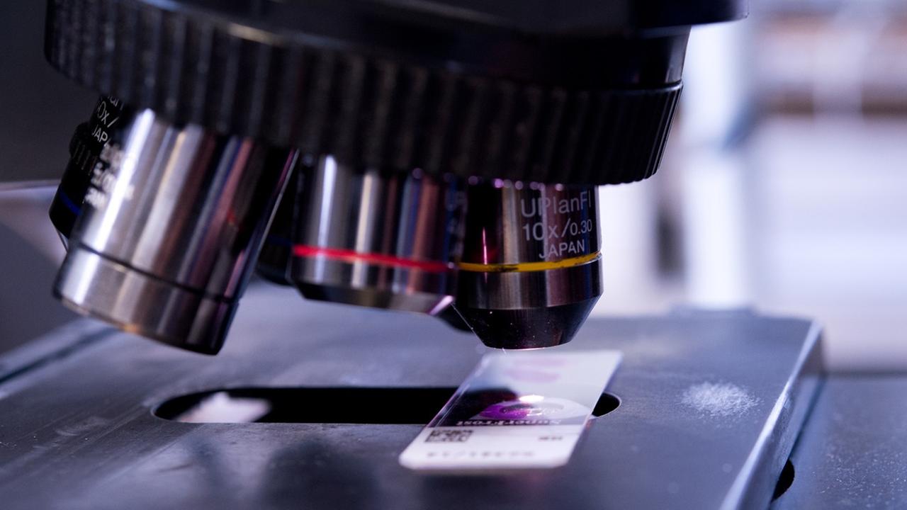 Ein Objektträger mit einer Gewebeprobe liegt am 21.04.2014 in einem Labor der Pathologie an der Charité in Berlin zur Untersuchung auf krankhafte Veränderungen unter einem Mikroskop.