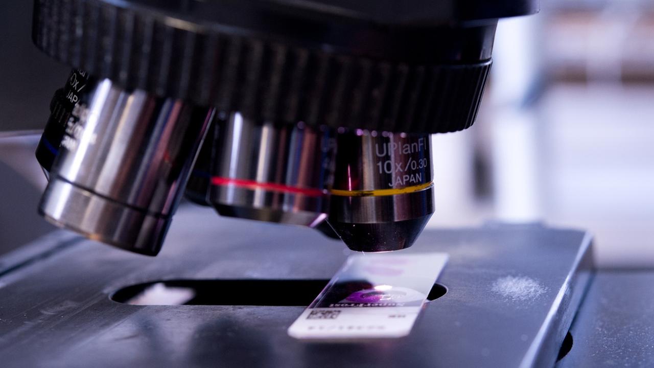 Ein Objektträger mit einer Gewebeprobe liegt am 21.04.2014 in einem Labor der Pathologie an der Charité in Berlin zur Untersuchung auf krankhafte Veränderungen unter einem Mikroskop. Ein Objektträger mit einer Gewebeprobe liegt am 21.04.2014 in einem Labor der Pathologie an der Charité in Berlin zur Untersuchung auf krankhafte Veränderungen unter einem Mikroskop.