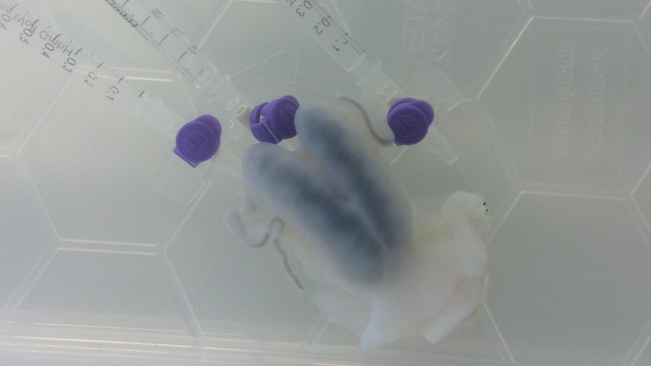 An der bläulichen Farbe ist zu erkennen, dass die Zellen noch nicht vollständig aus dem Uterus herausgewaschen sind An der bläulichen Farbe ist zu erkennen, dass die Zellen noch nicht vollständig aus dem Uterus herausgewaschen sind