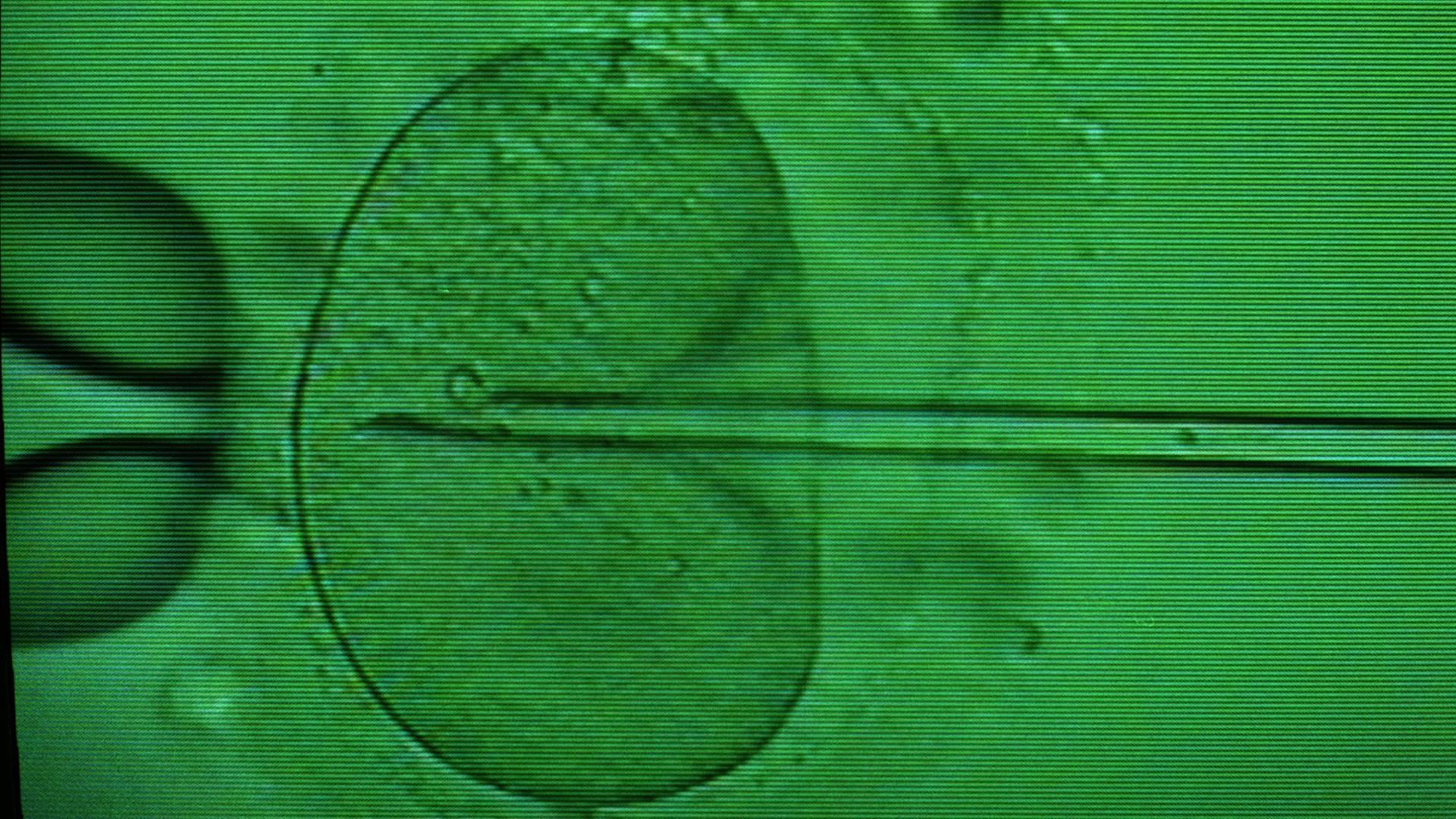 Das Monitorfoto zeigt das Einbringen einer Samenzelle in eine Eizelle mittels Mikropipette unter dem Mikroskop. Das Monitorfoto zeigt das Einbringen einer Samenzelle in eine Eizelle mittels Mikropipette unter dem Mikroskop.