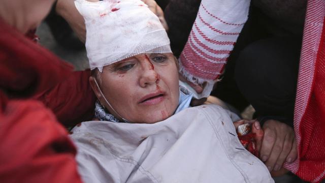 Eine verletzte Demonstrantin in Minsk, Belarus am 23.09.2020