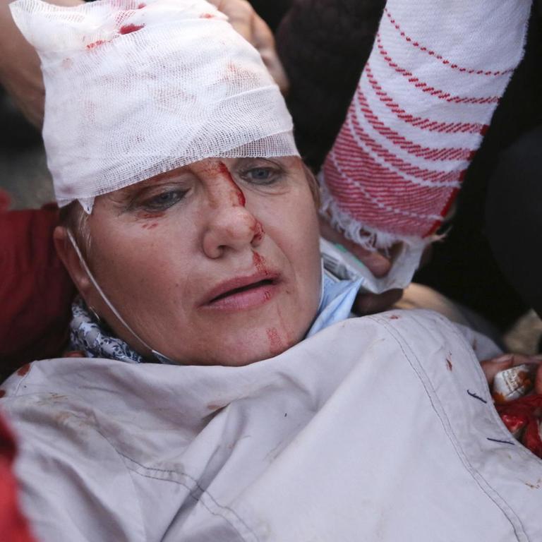 Eine verletzte Demonstrantin in Minsk, Belarus am 23.09.2020
