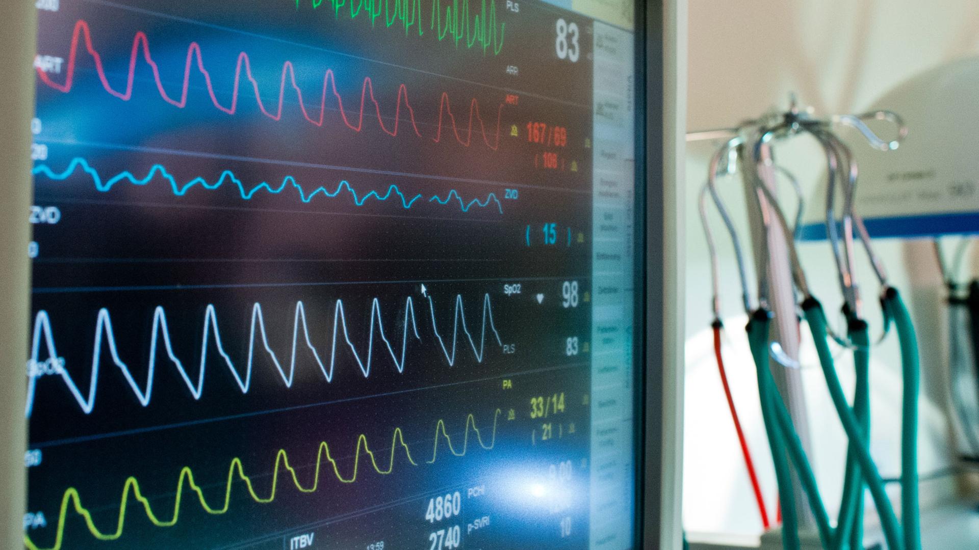 Ein Vitaldatenmonitor im Medizinischen Kompetenzzentrum in Wendisch-Rietz (Brandenburg), aufgenommen am 25.02.2014. Ein Vitaldatenmonitor im Medizinischen Kompetenzzentrum in Wendisch-Rietz (Brandenburg), aufgenommen am 25.02.2014.