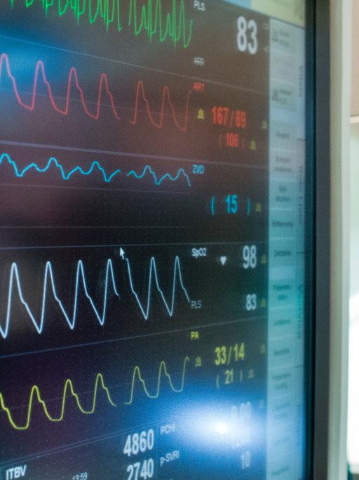 Ansicht eines Vitaldatenmonitors: Die Fortschritte in der Telemedizin machen es nun auch möglich Patienten von zu Hause aus kardiologisch zu überwachen. 